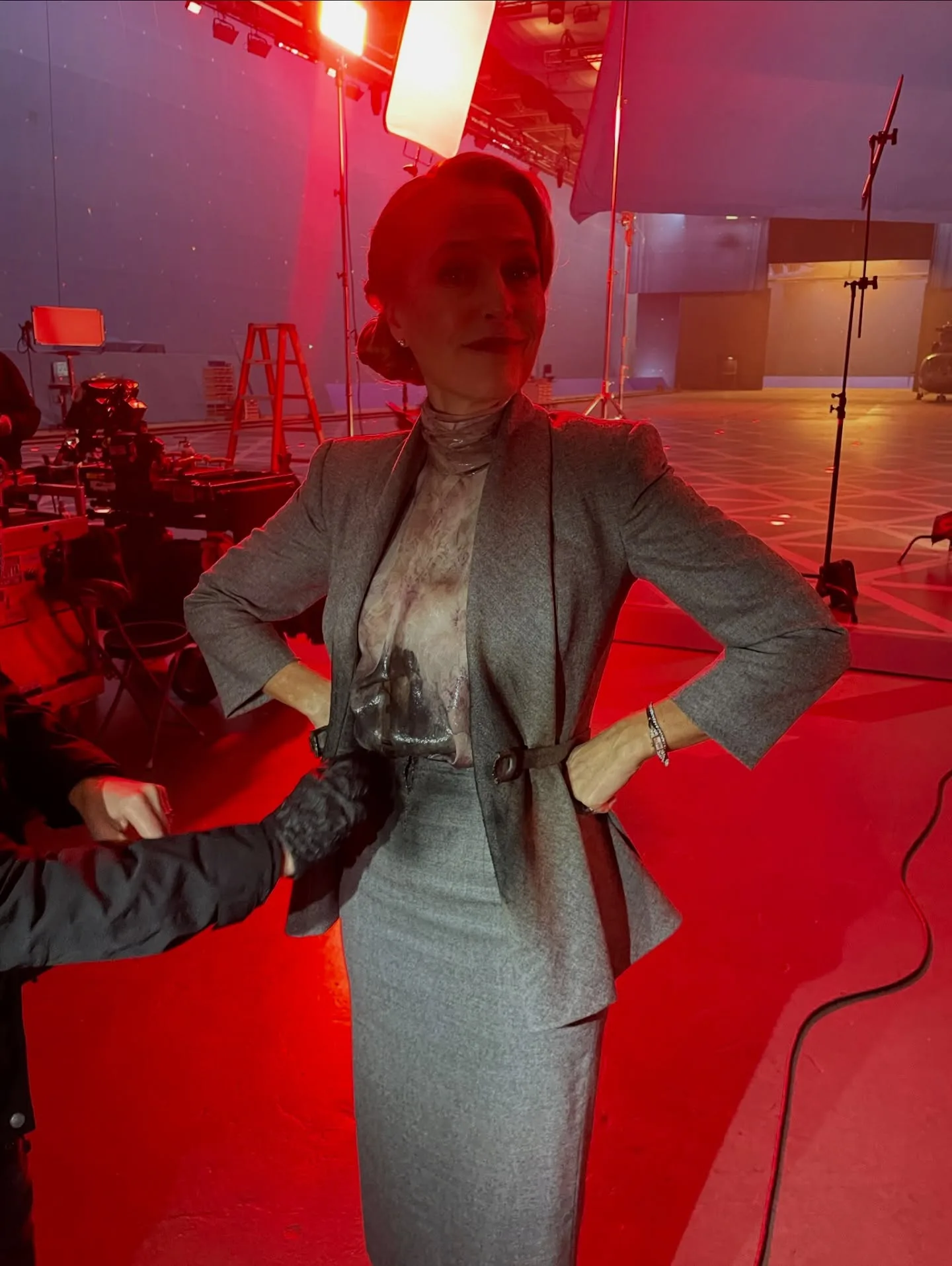 Gillian Anderson в кадрі — розсекречено: поранений живіт на зйомках